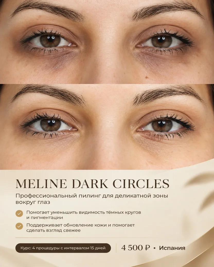 🌟 Представляем инновационный протокол MELINE DARK CIRCLES 🌟