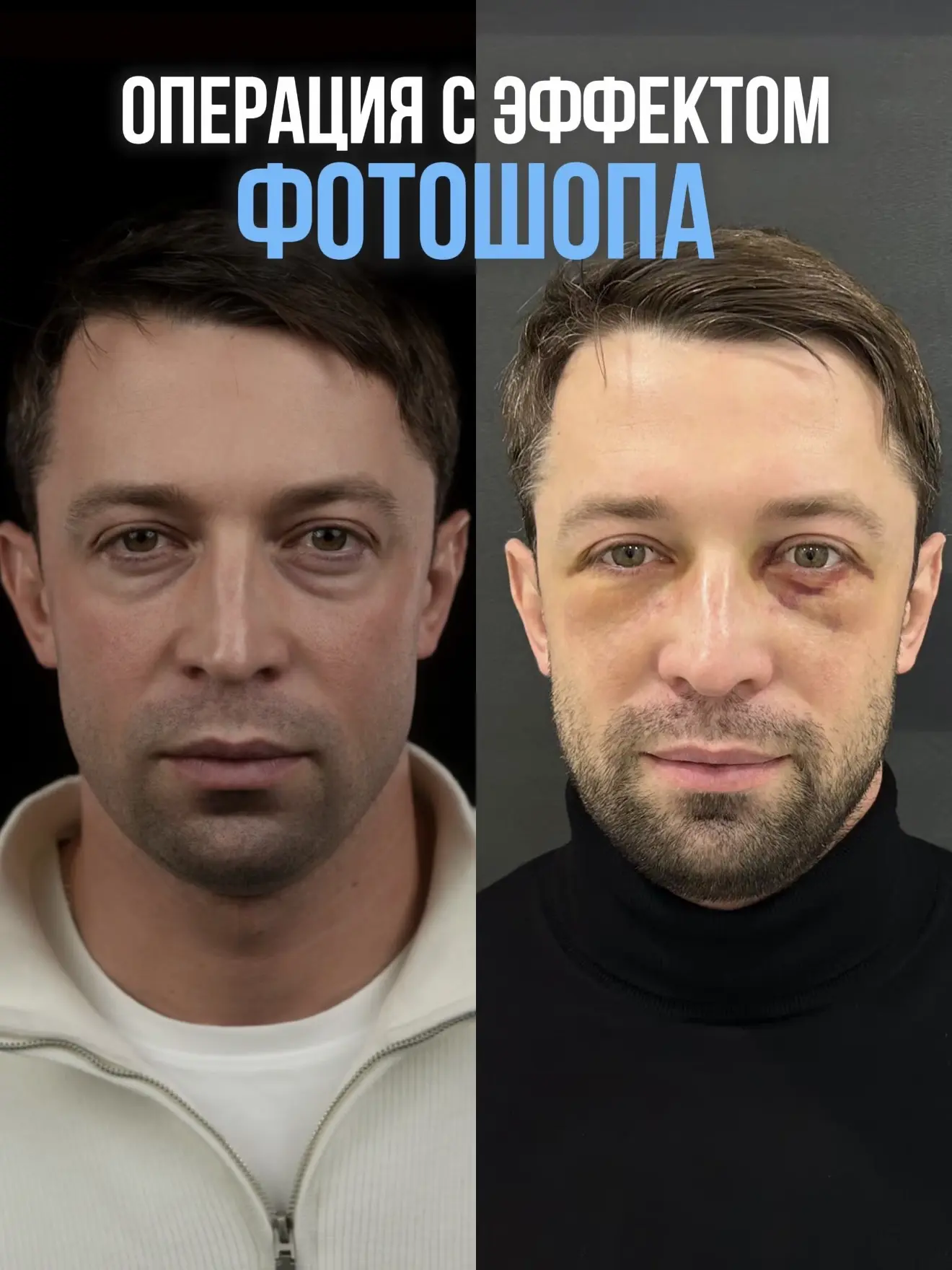 Хирургия с эффектом фотошопа🔥