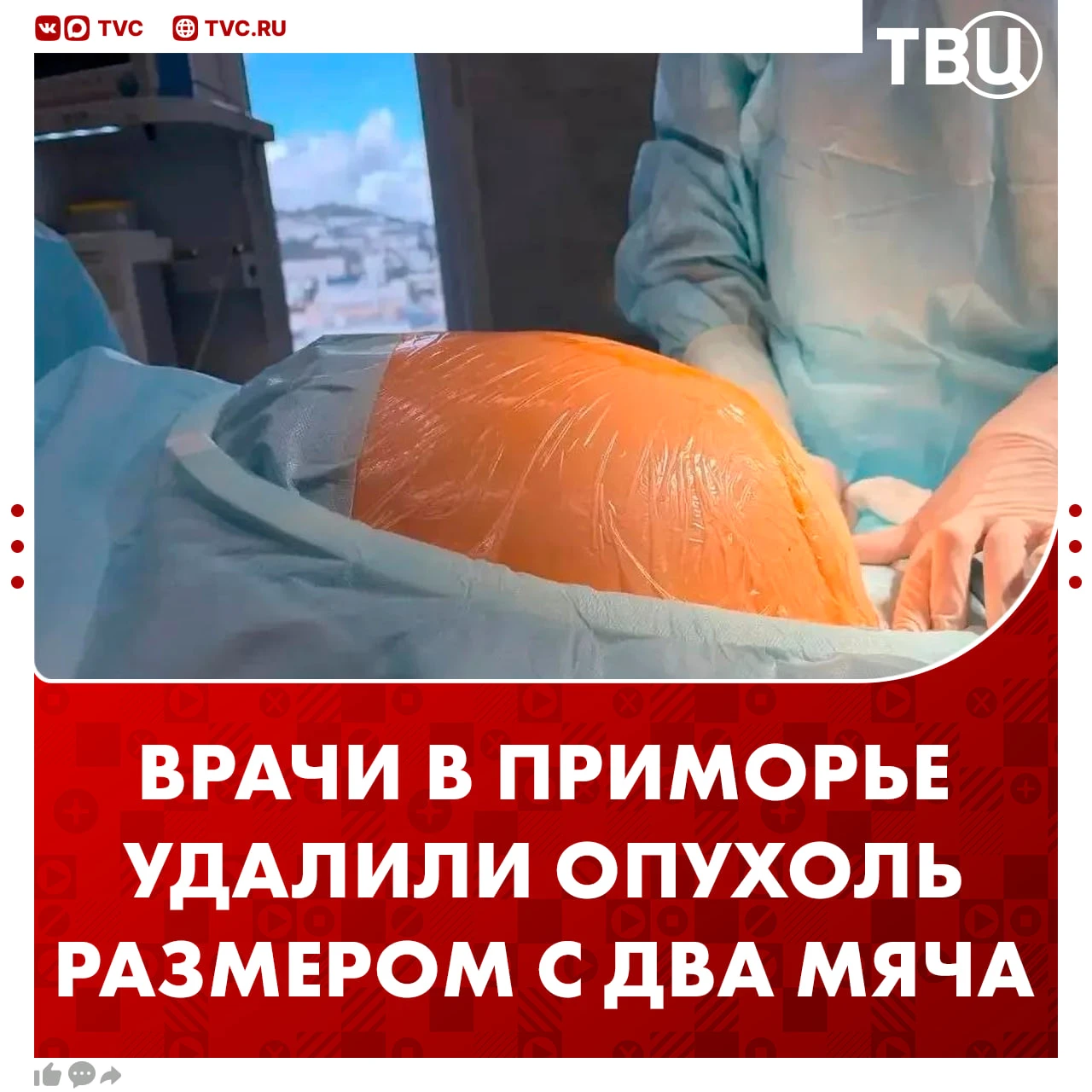😱 Жительнице Владивостока удалили опухоль размером больше двух баскетбольных мячей