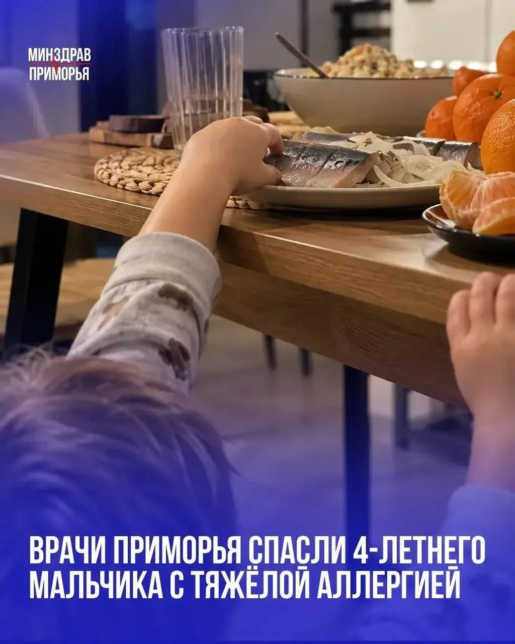 «Стащил рыбу и закусил апельсином»: в краевую детскую больницу привезли мальчика с остр...