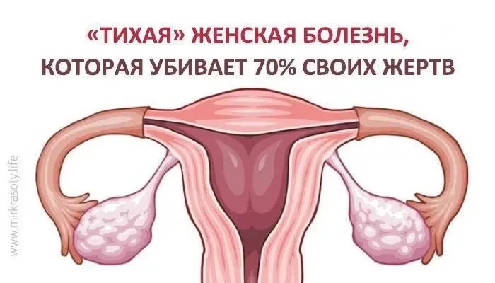Тихая женская болезнь, которая убивает 70% своих жертв У нее нет симптомов.