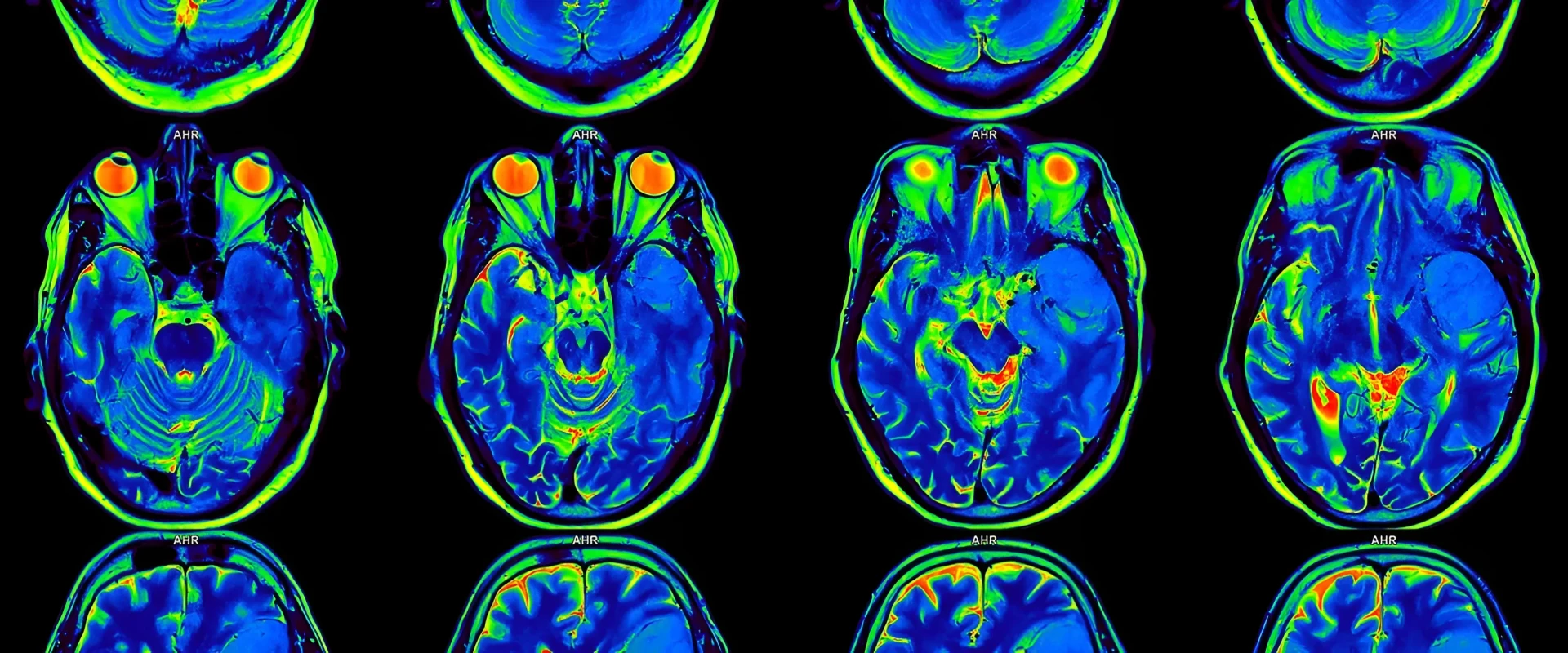 🧠 Вода может стать ключом к разгадке запутанной тайны болезни Альцгеймера💧