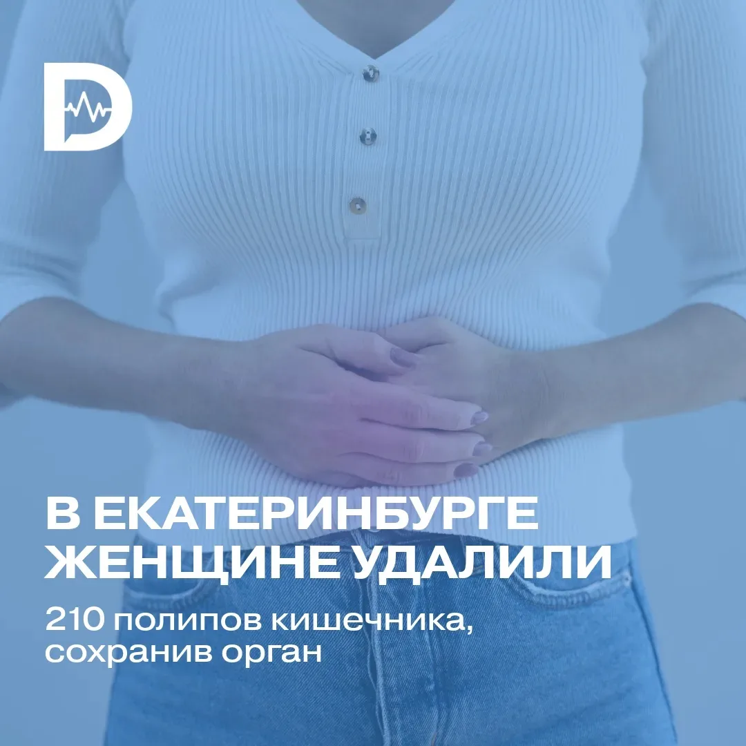 🔍 Удаление полипов: сложная операция с успешным исходом!