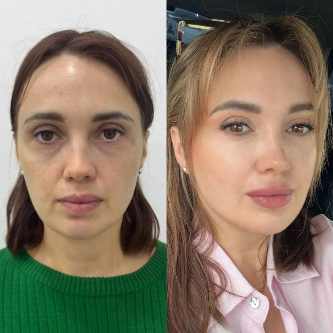 💚 Вау-результат