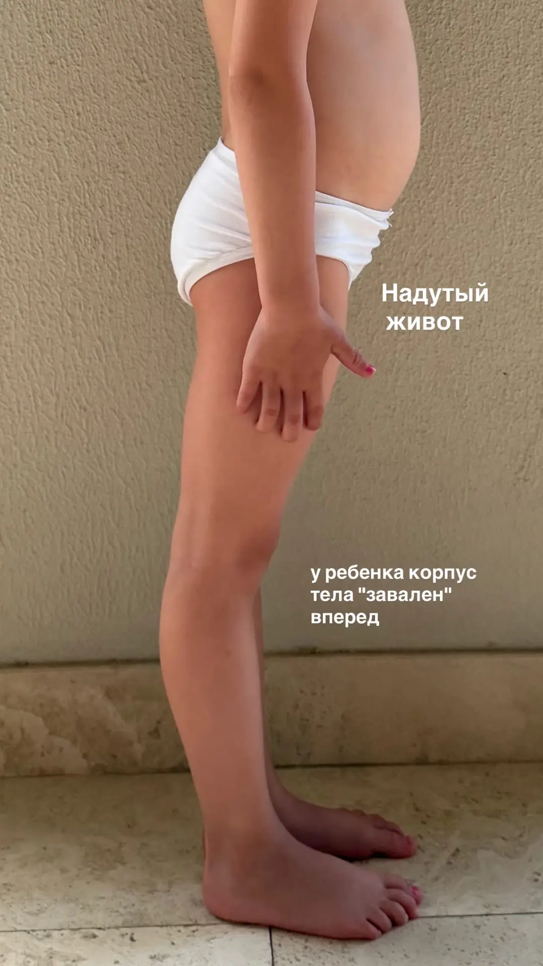 Как напряжение живота у ребенка влияет на всю композицию тела?