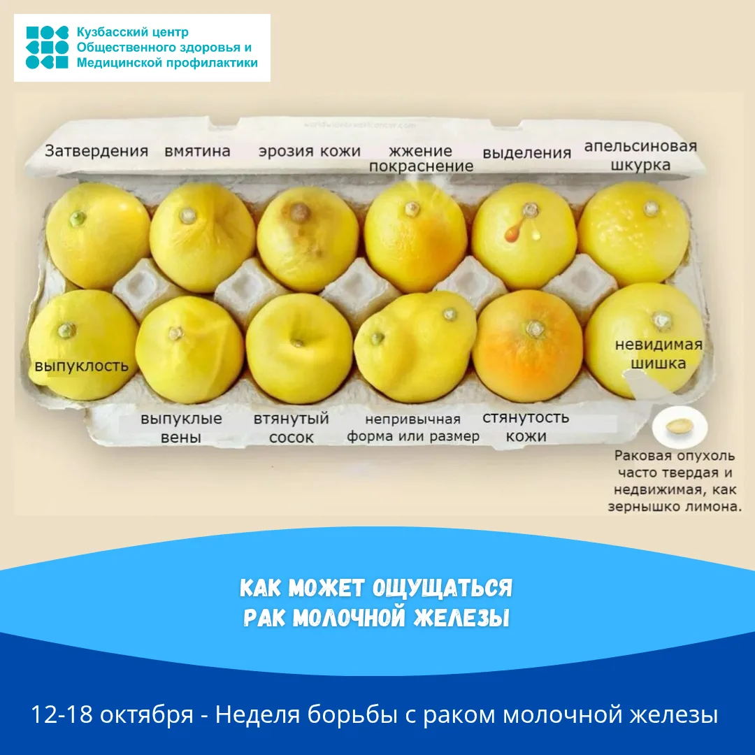 📍Рак молочной железы РМЖ находится на первом месте в структуре онкологических заболева...