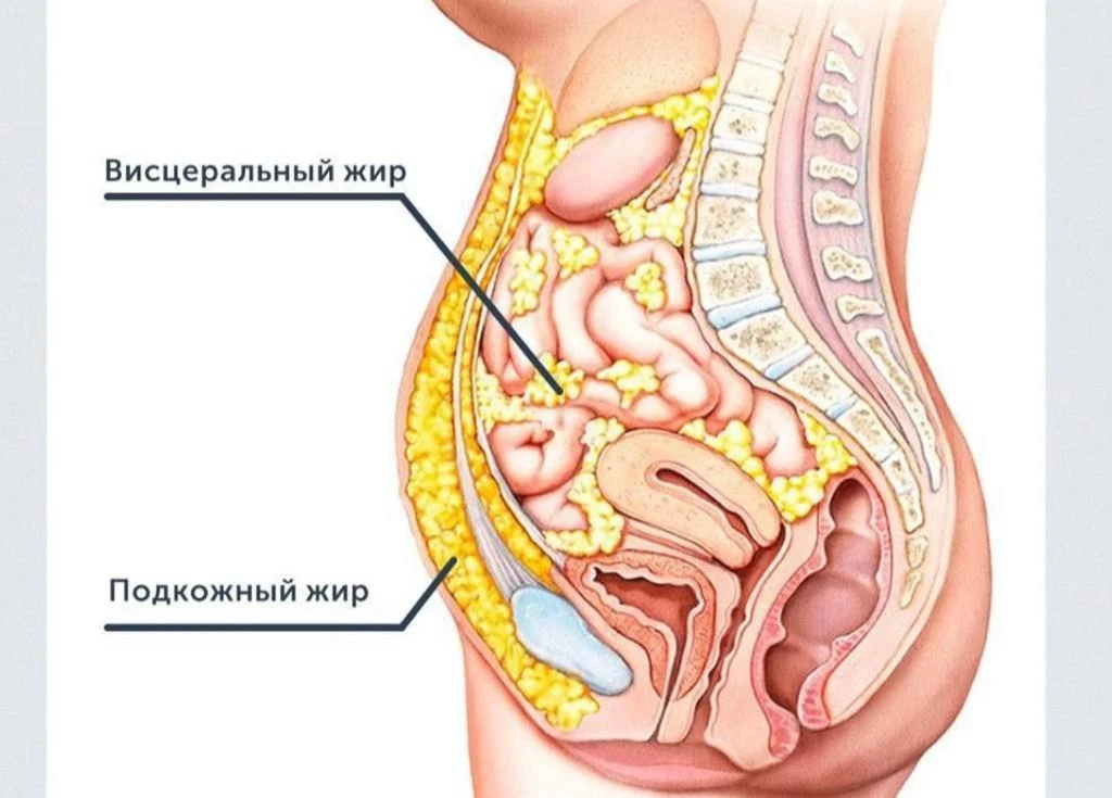 ЧЕМ ОПАСЕН ВИСЦЕРАЛЬНЫЙ ЖИР❗