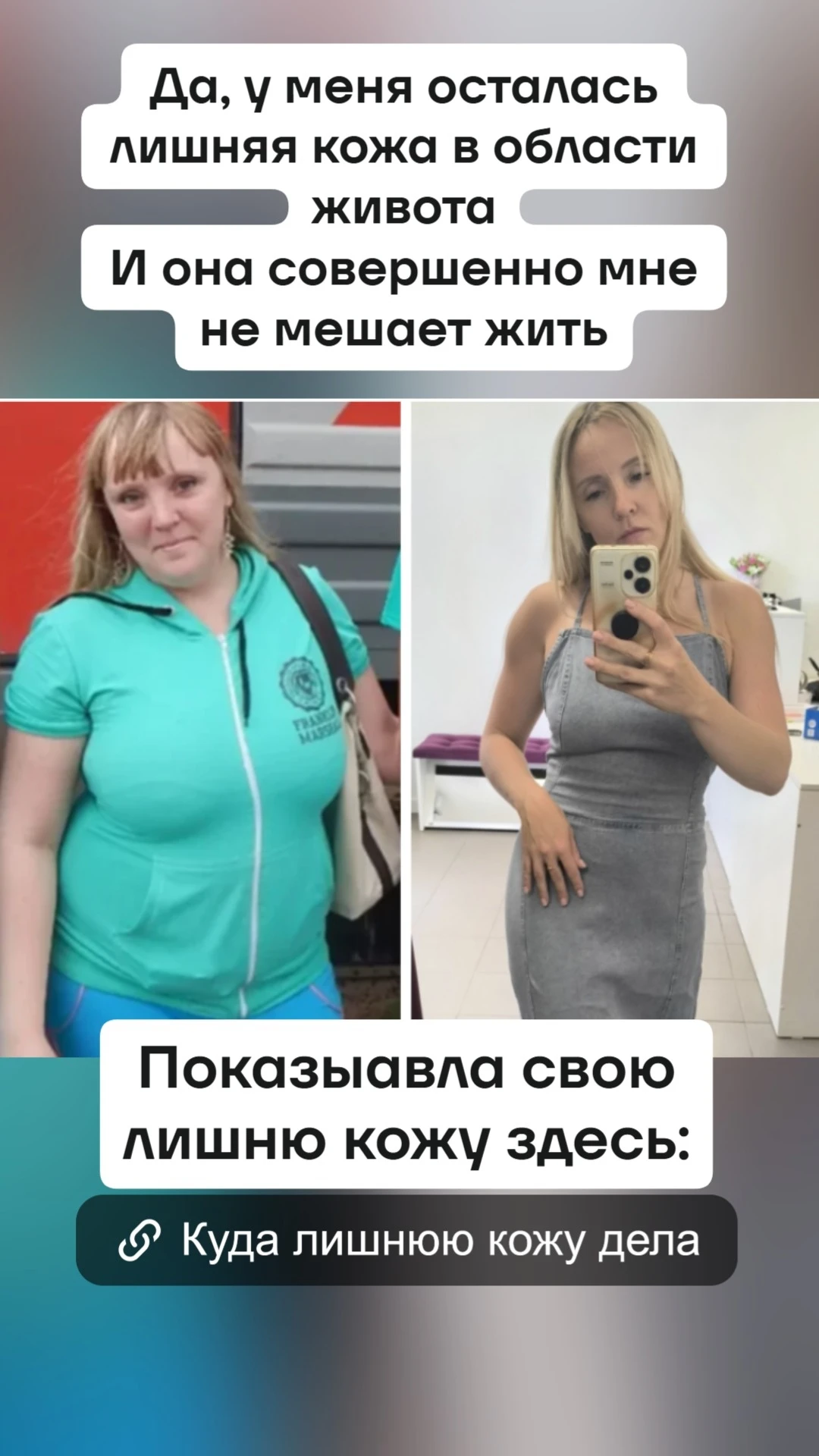 💢Один из самых частых вопросов в блоге про похудение - куда кожу дела!? Обычно именно ...