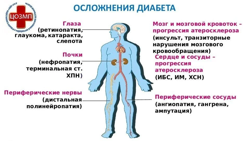 📌Осложнение диабета