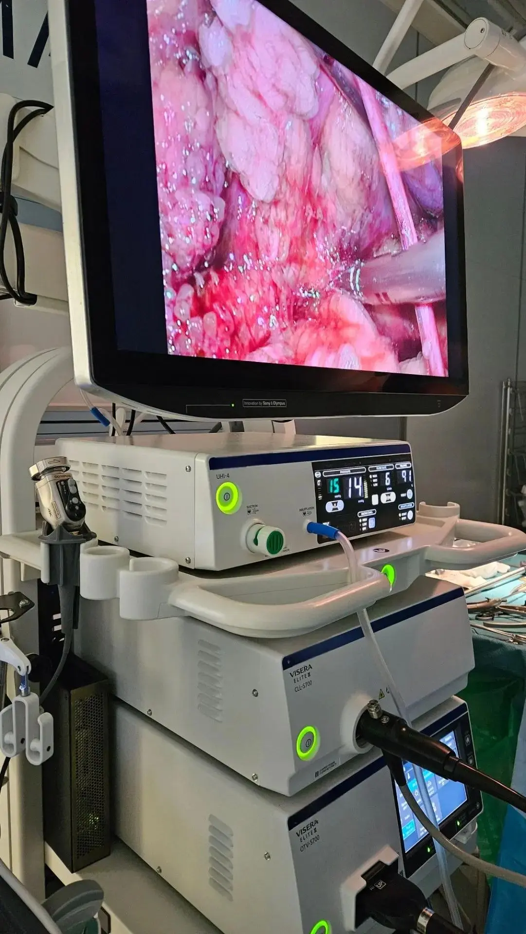🏥Больницы Мурманской области получат 31 единицу нового медицинского оборудования