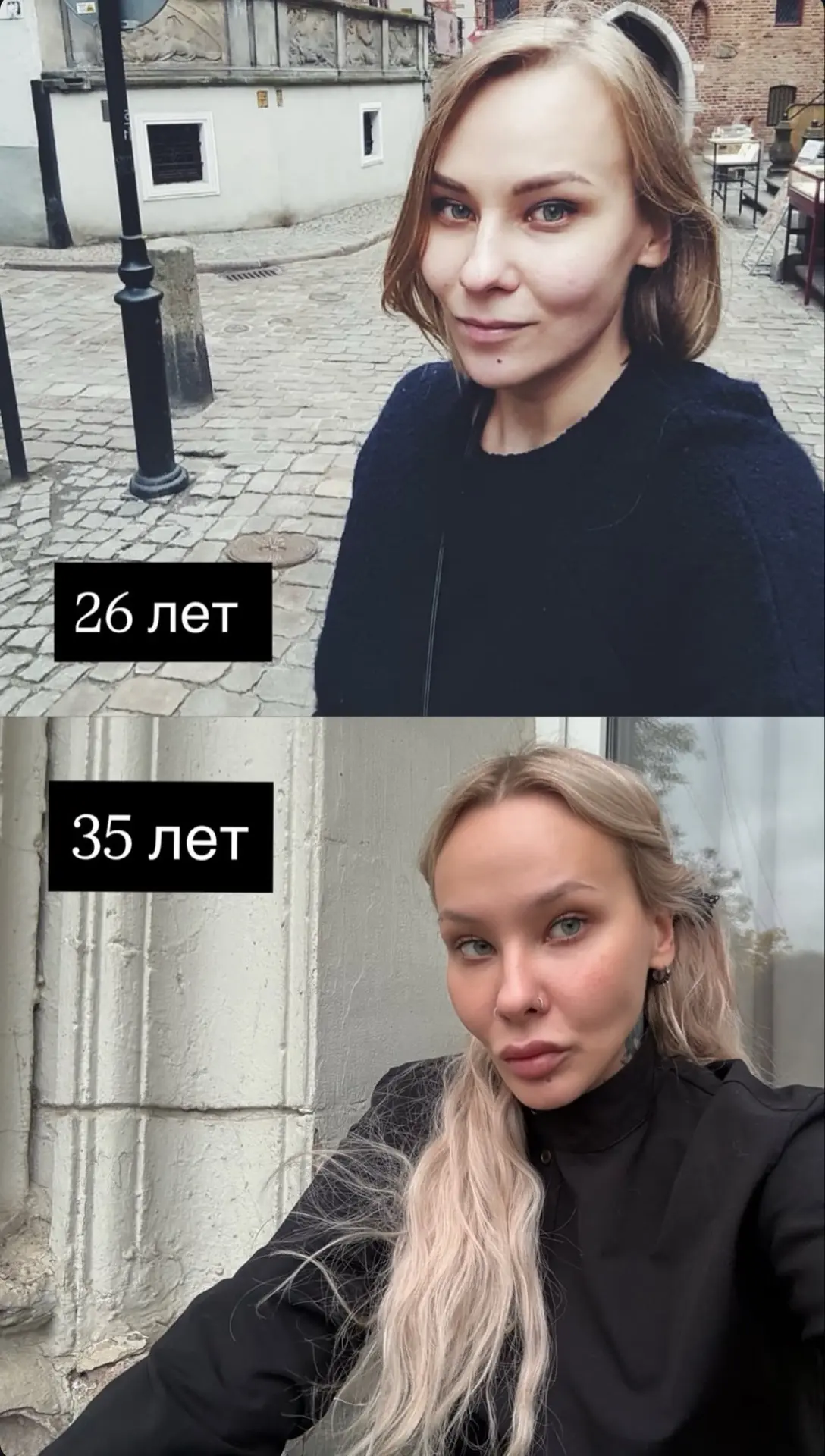 Лера сказала, что восхищается положением моих щек — они с возрастом сползают вниз, но м...
