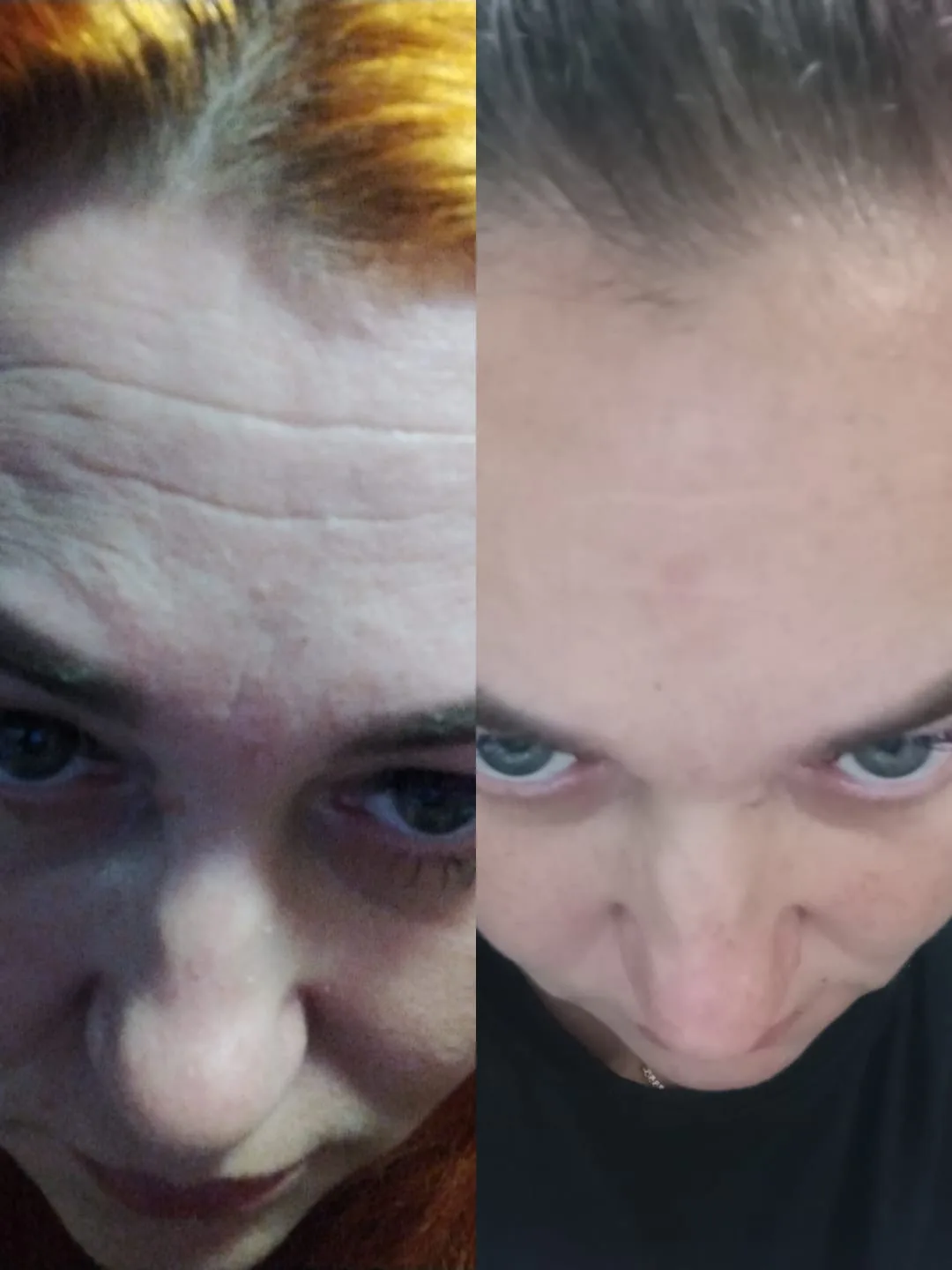 Сказать что это восторг, ничего не сказать. Фото слева делала для косметолога, хотела д...