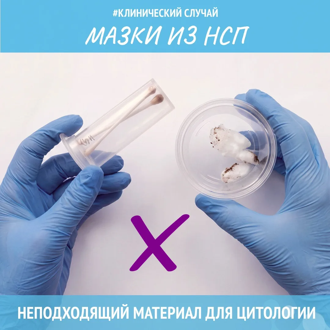 #преаналитика