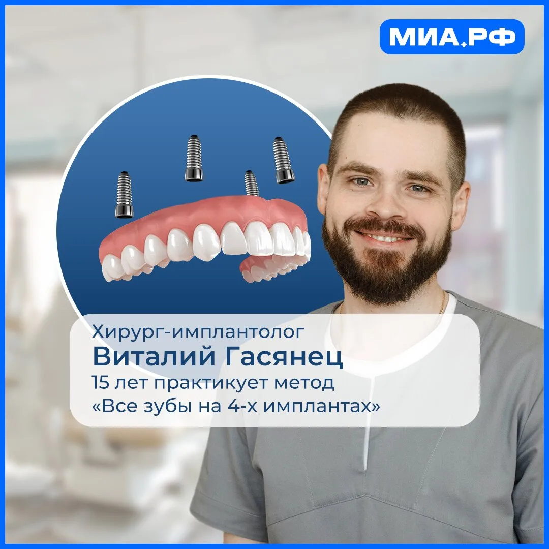 Протезирование сразу всех зубов челюсти на 4х имплантах!