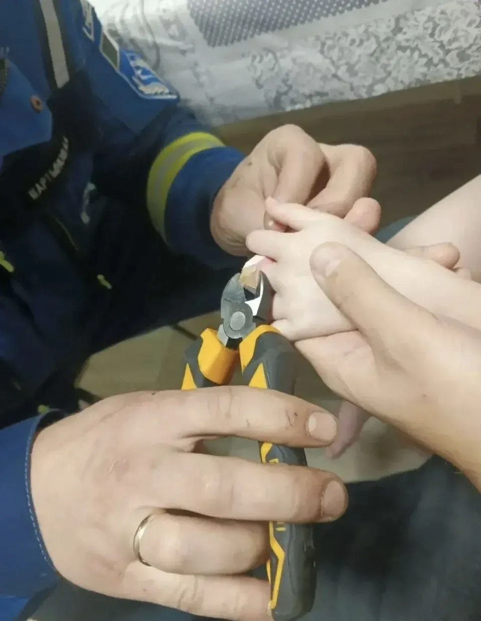 Палец малышки из Ижевска застрял в конструкторе