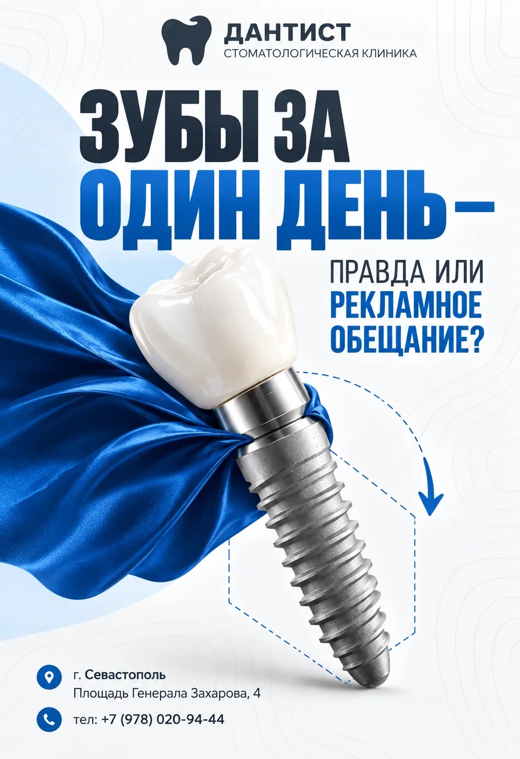🦷 ЗУБЫ ЗА ОДИН ДЕНЬ — ПРАВДА ИЛИ РЕКЛАМНОЕ ОБЕЩАНИЕ?