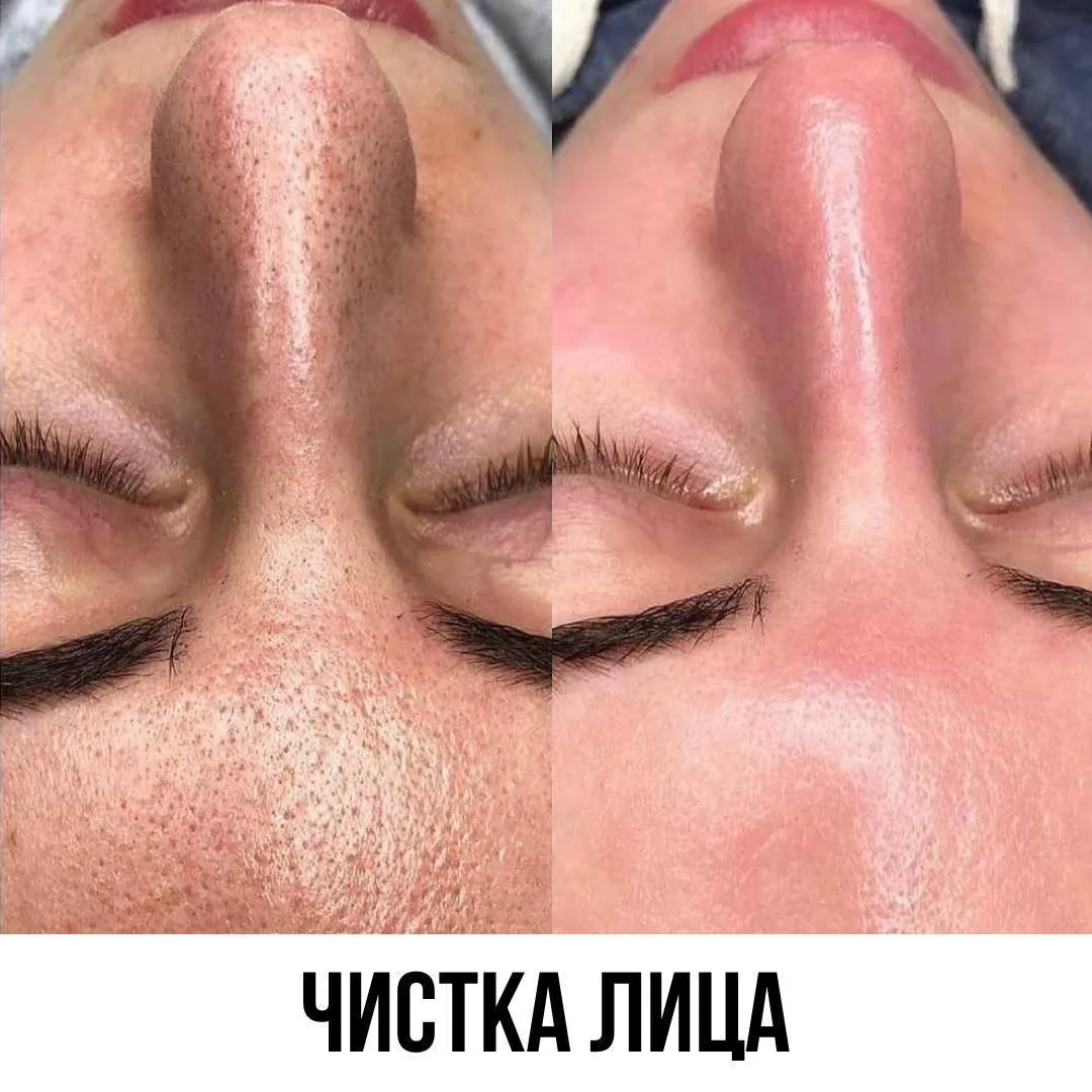 КОСМЕТОЛОГ БУТОВО