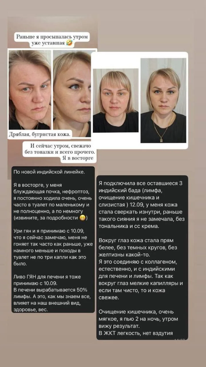 💋Отзывы о линейке Аюрведы