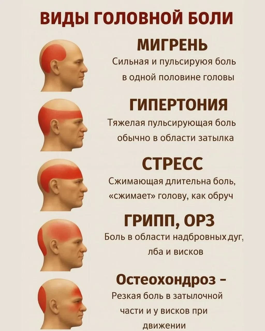 Виды головной боли ✍️