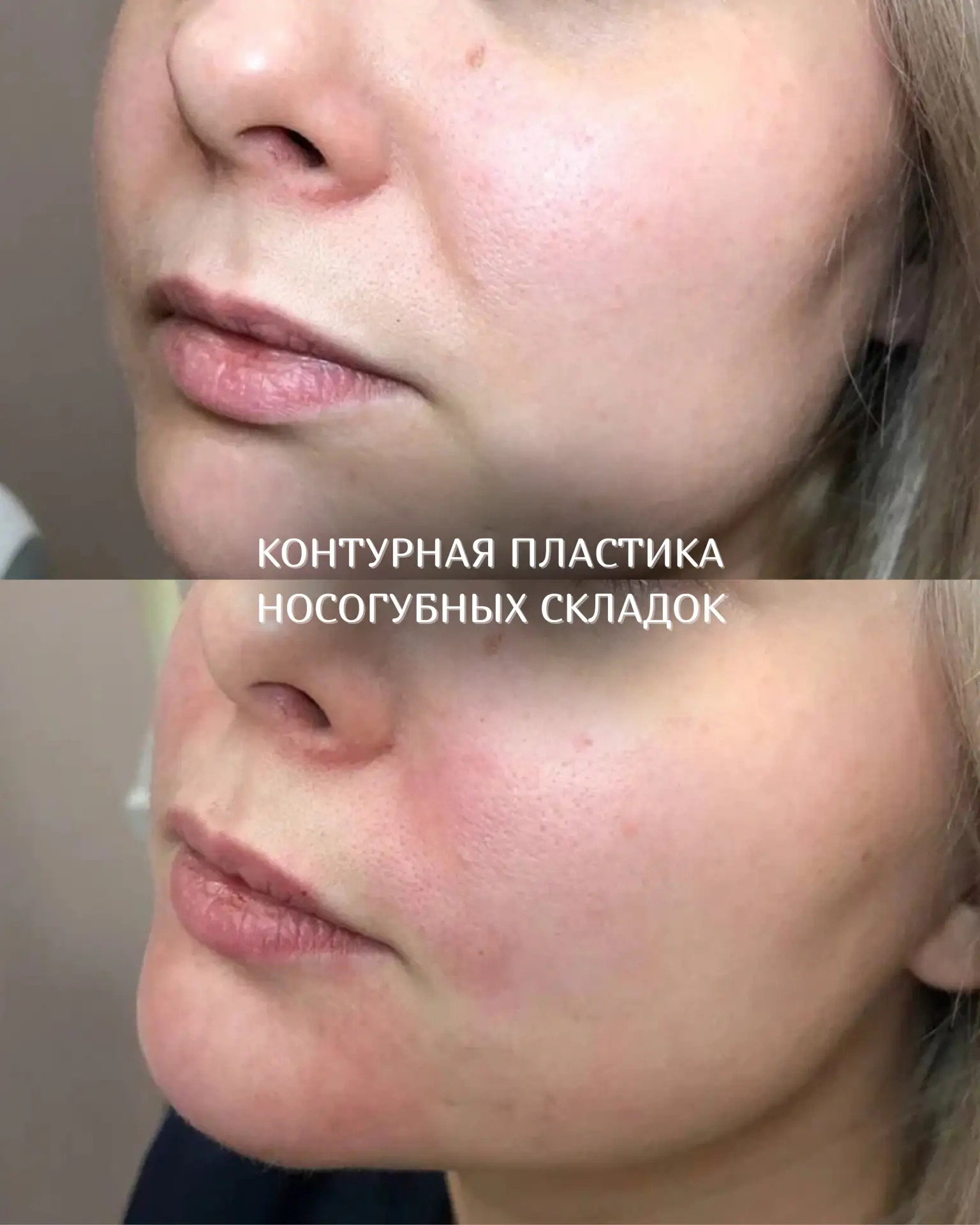 Свежее лицо за один визит ✨