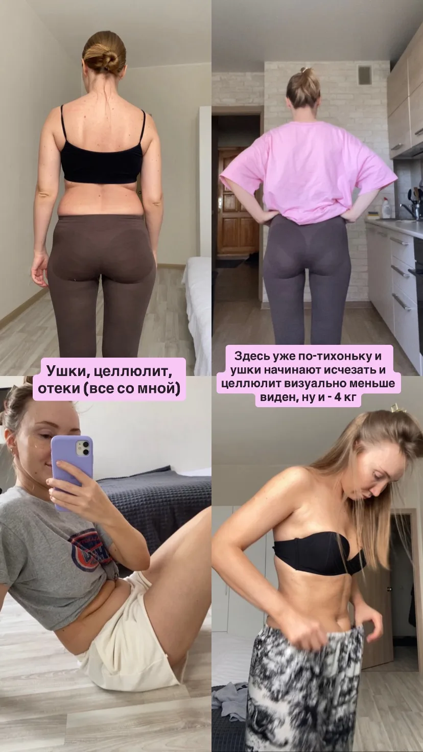 Целлюлит, отёки и ушки на бёдрах: что делать? ⚡️🤯