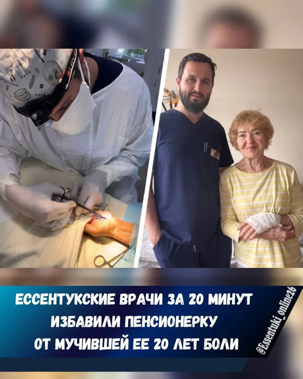 20 лет боли сняли одной операцией