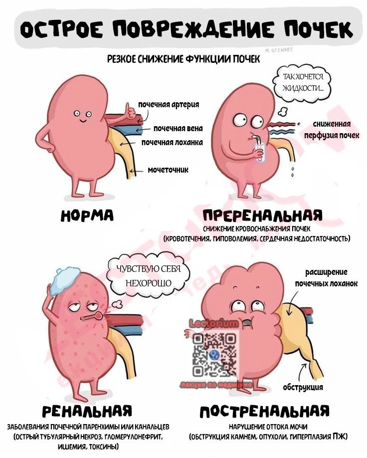 Острое повреждение почек