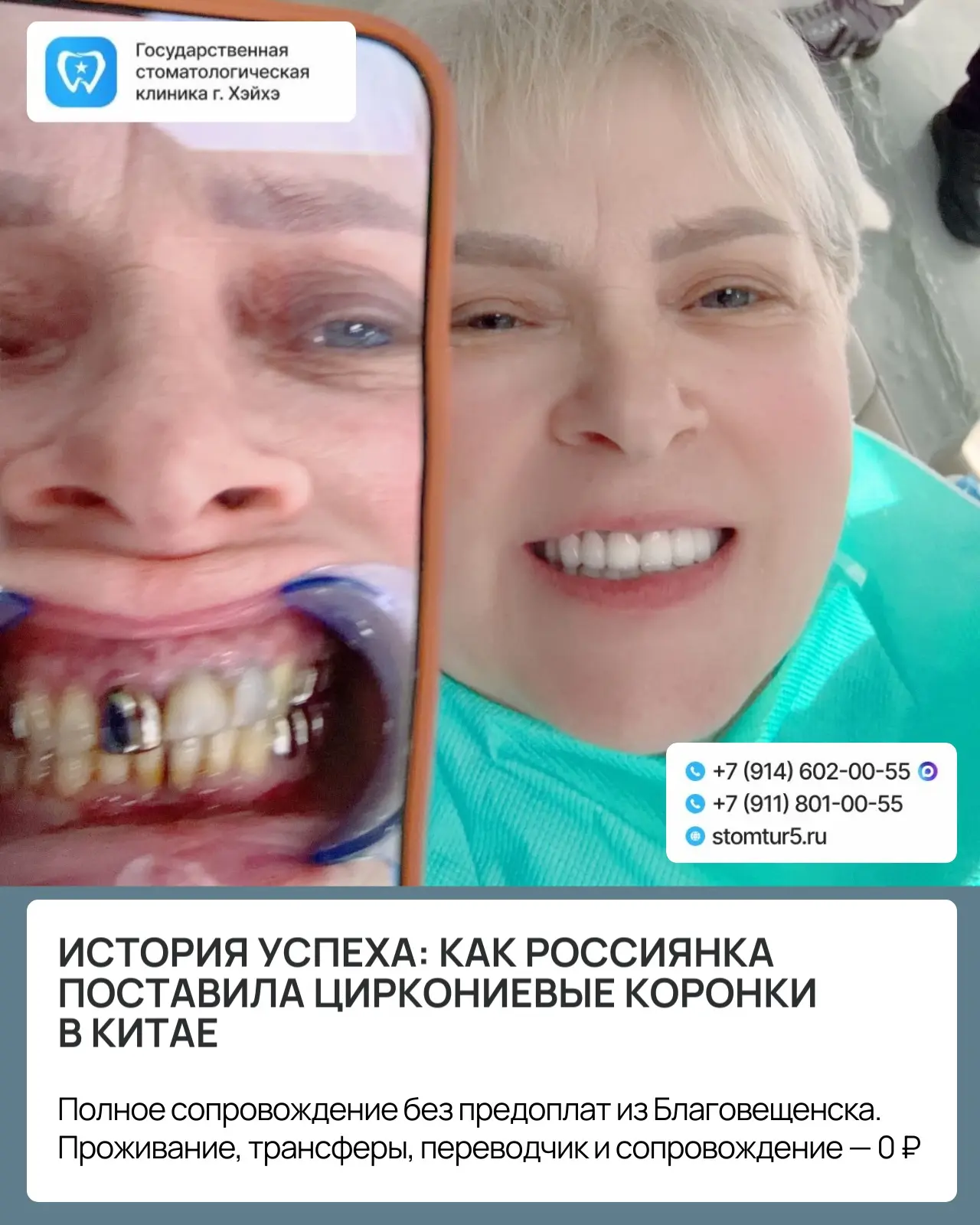 «Я боялась улыбаться. А теперь не могу перестать!»
