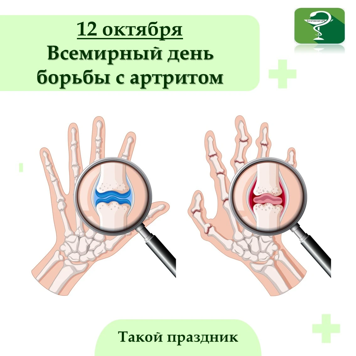12 октября отмечается Всемирный день борьбы с артритом