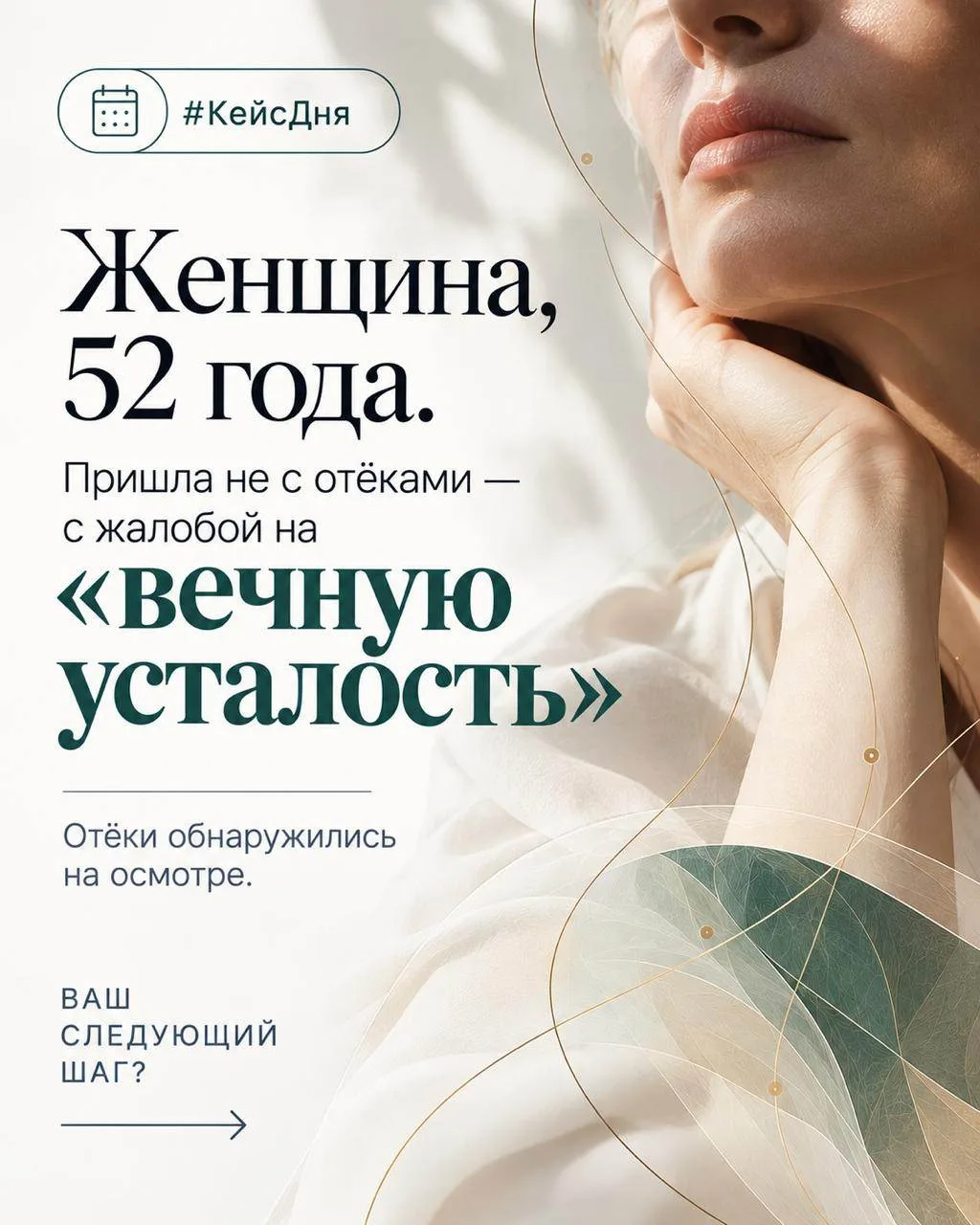 Женщина, 52 года. Пришла не с отёками, а с жалобой на «вечную усталость». Отёки обнаруж...
