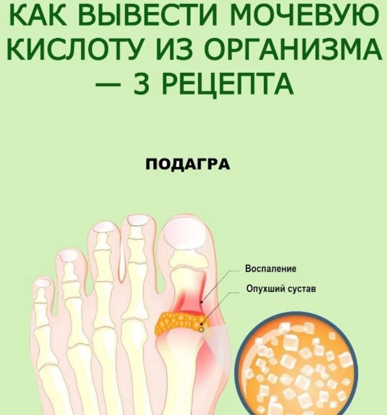 Выводим мочевую кислоту из организма!