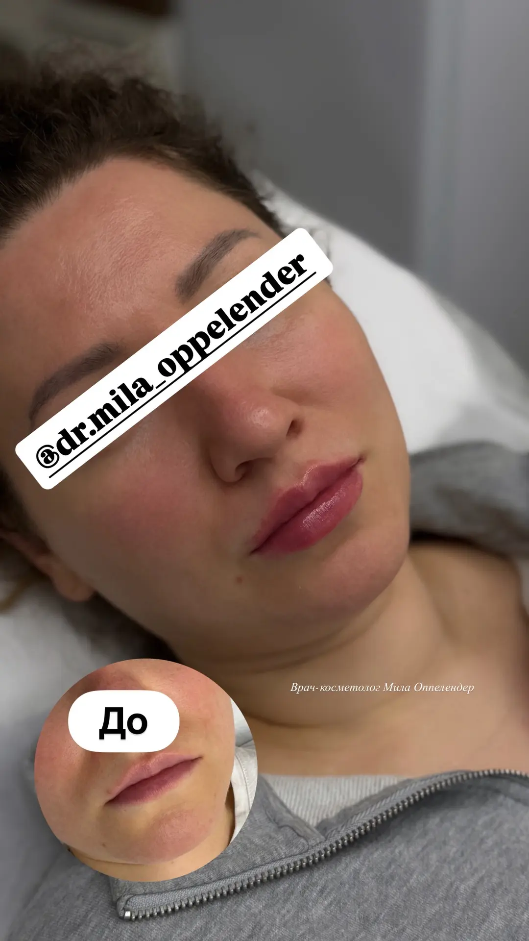 Сделаю ваши губы желанными👄 Исправлю ассиметрию, придам нужный объем и подарю неповтор...