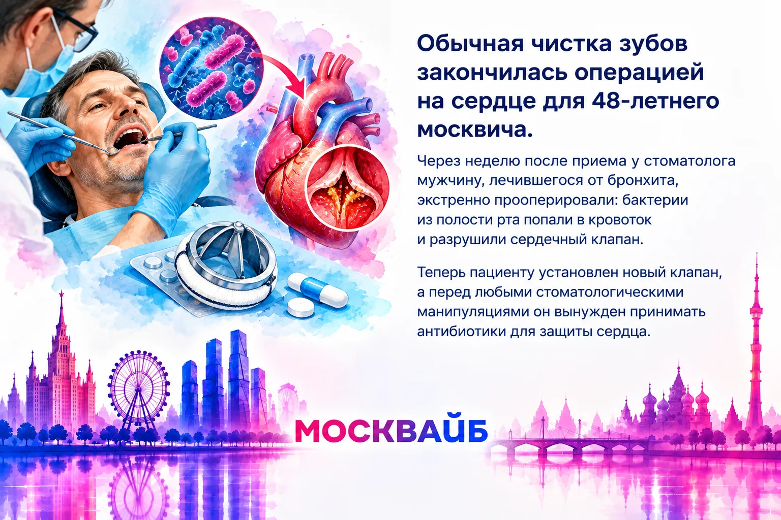 🫀Обычная чистка зубов закончилась операцией на сердце для 48-летнего москвича.