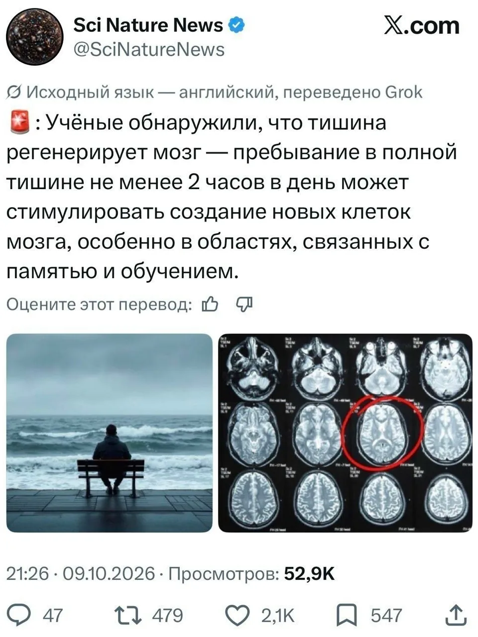Тишина регенерирует мозг — простое пребывание в полной тишине по 2 часа в день стимулир...