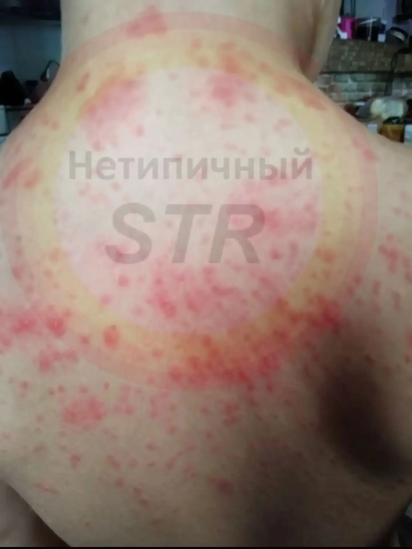 От подписчика:
