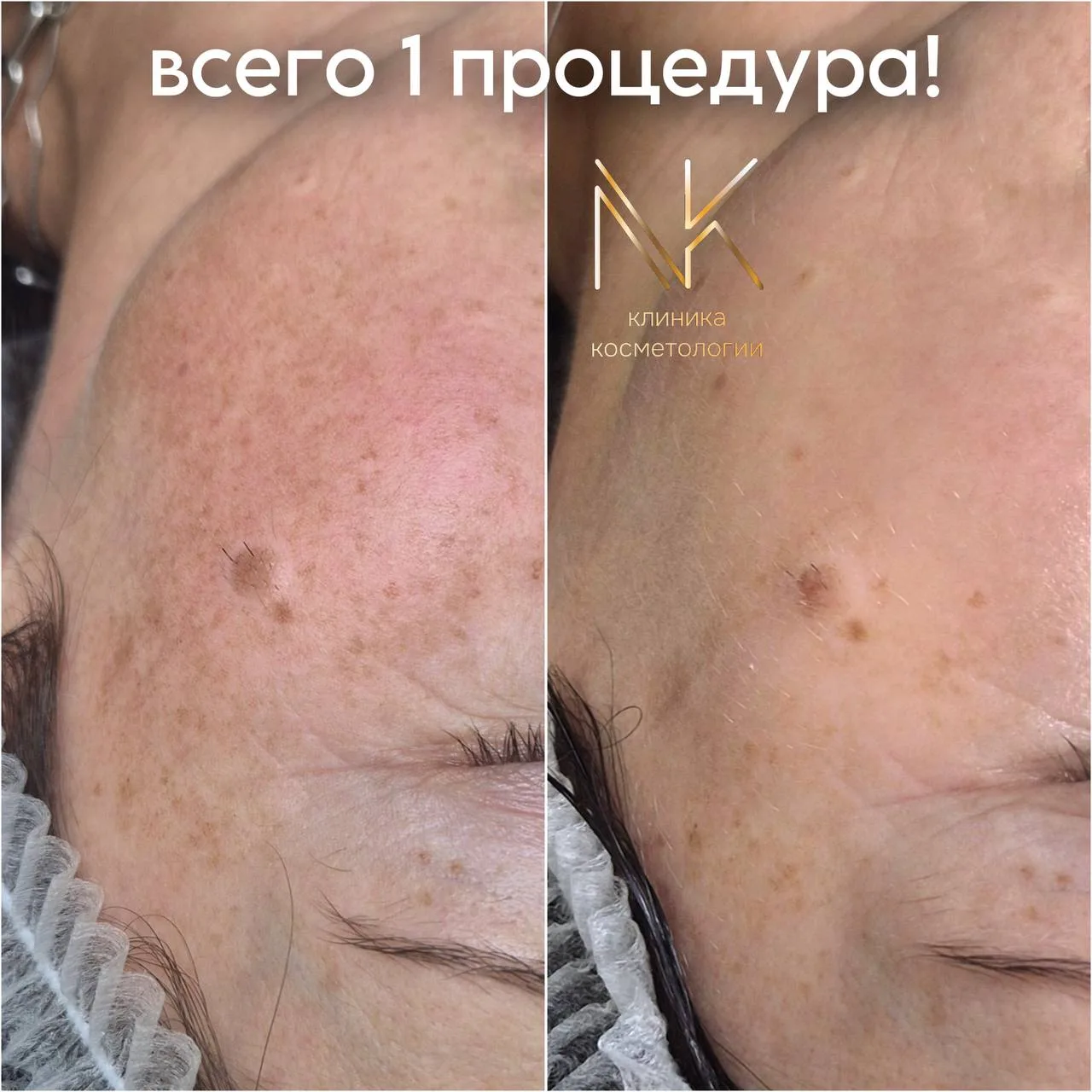 Минус 10 лет сразу!