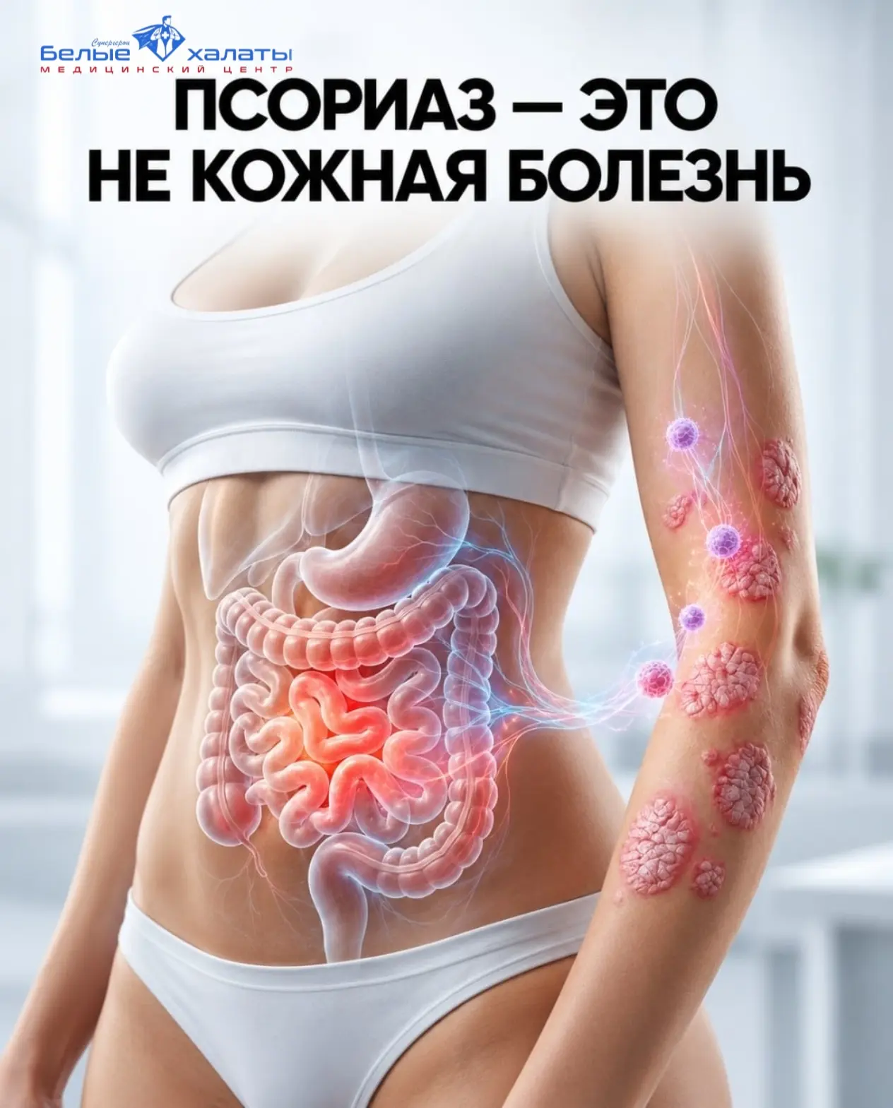 ПСОРИАЗ — ЭТО НЕ КОЖНАЯ БОЛЕЗНЬ⁉️