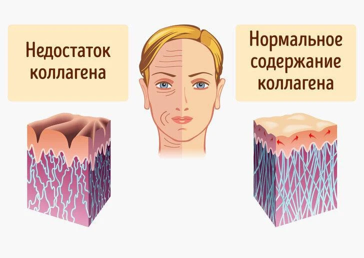 Увы. Это неизбежный биологический процесс
