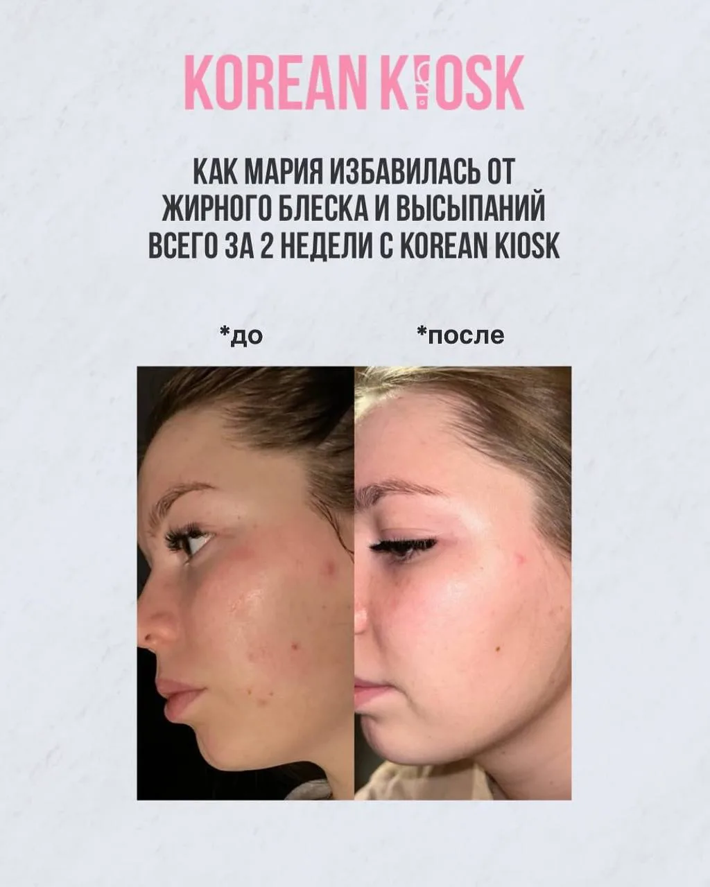 Результаты нашей клиентки после диагностики и правильно подобранного системного ухода😍