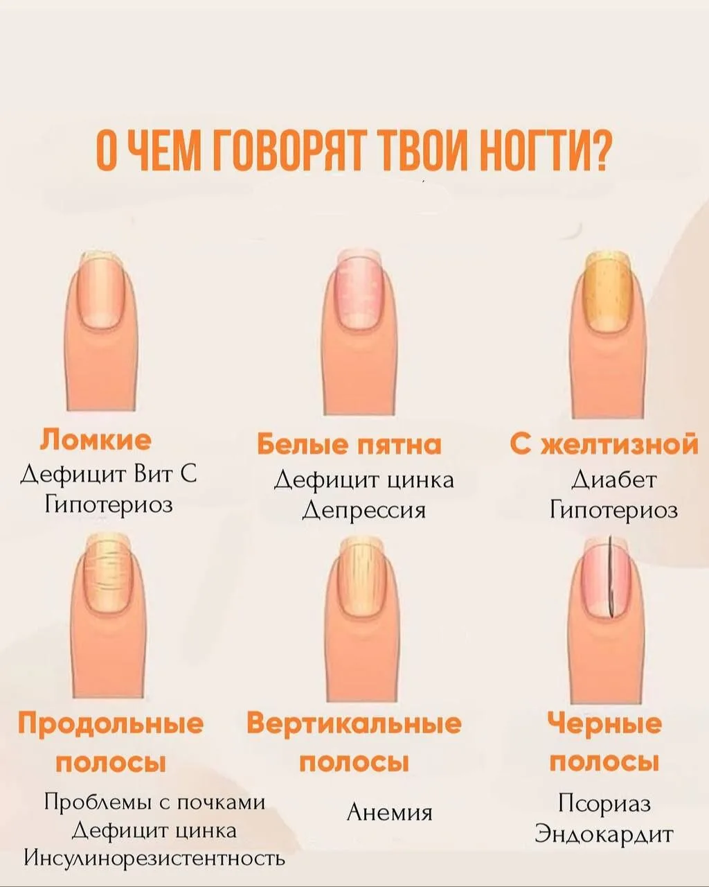 О чем говорят ваши ногти?