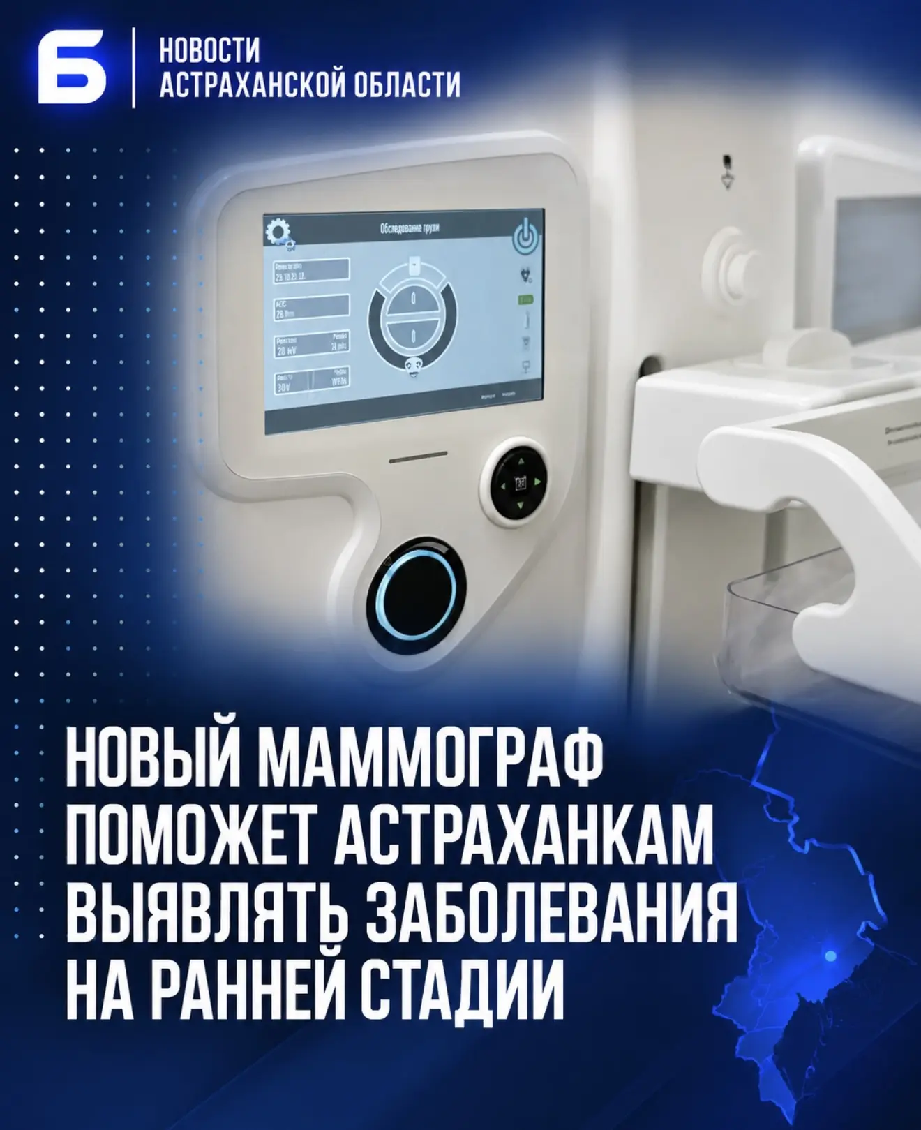 Новый маммограф поможет астраханкам выявлять заболевания на ранней стадии