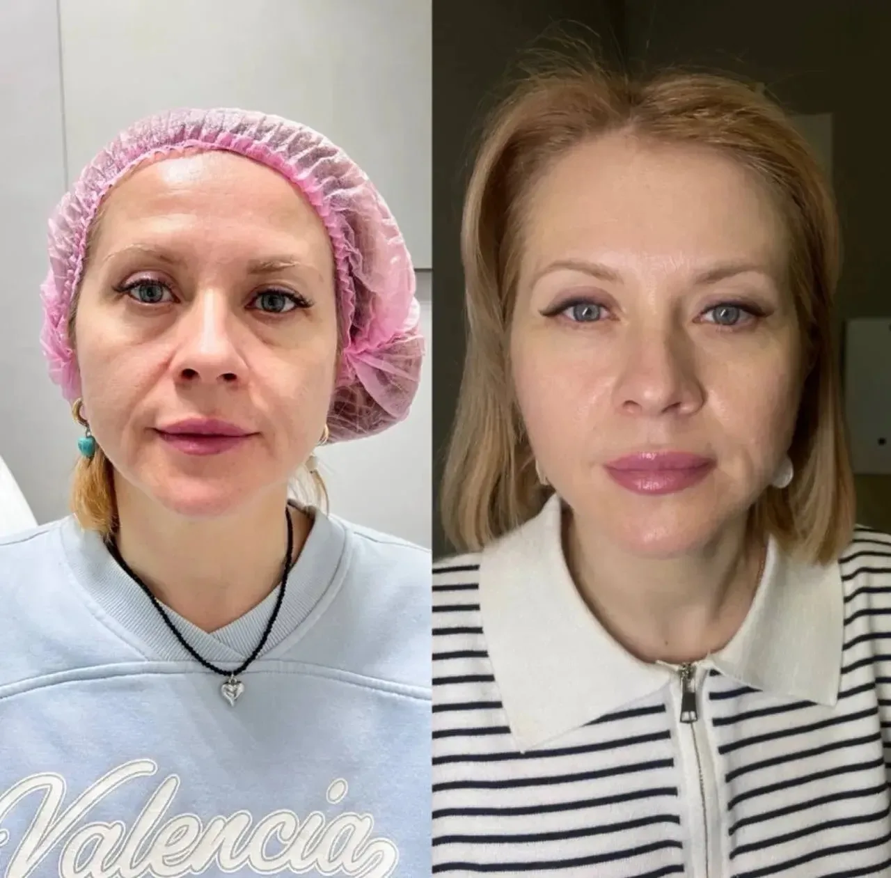 ✨ Прорыв в косметологии! BEAUTYGEL NAD GLOBAL✨
