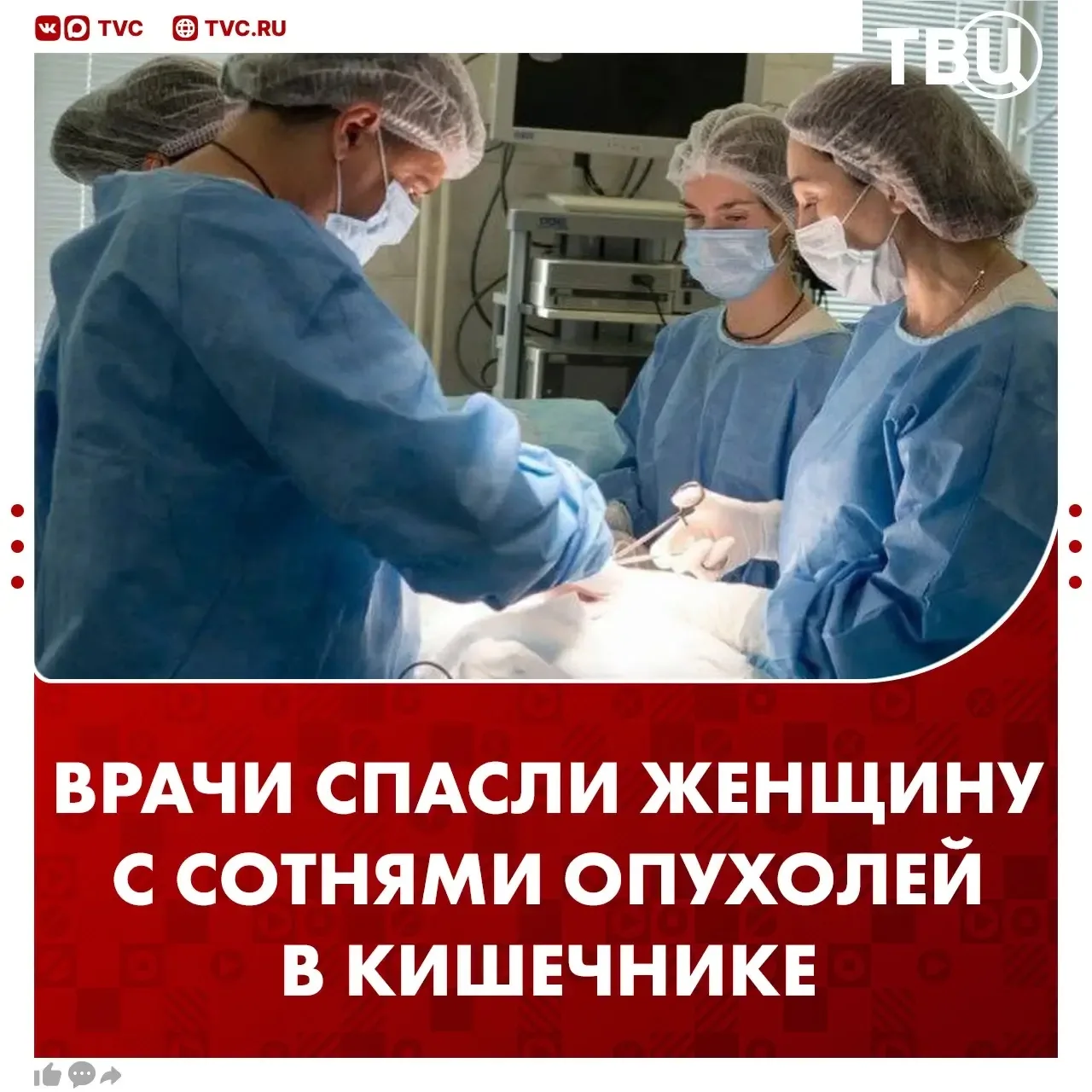 Врачи спасли женщину с 210 опухолями в кишечнике и сохранили орган