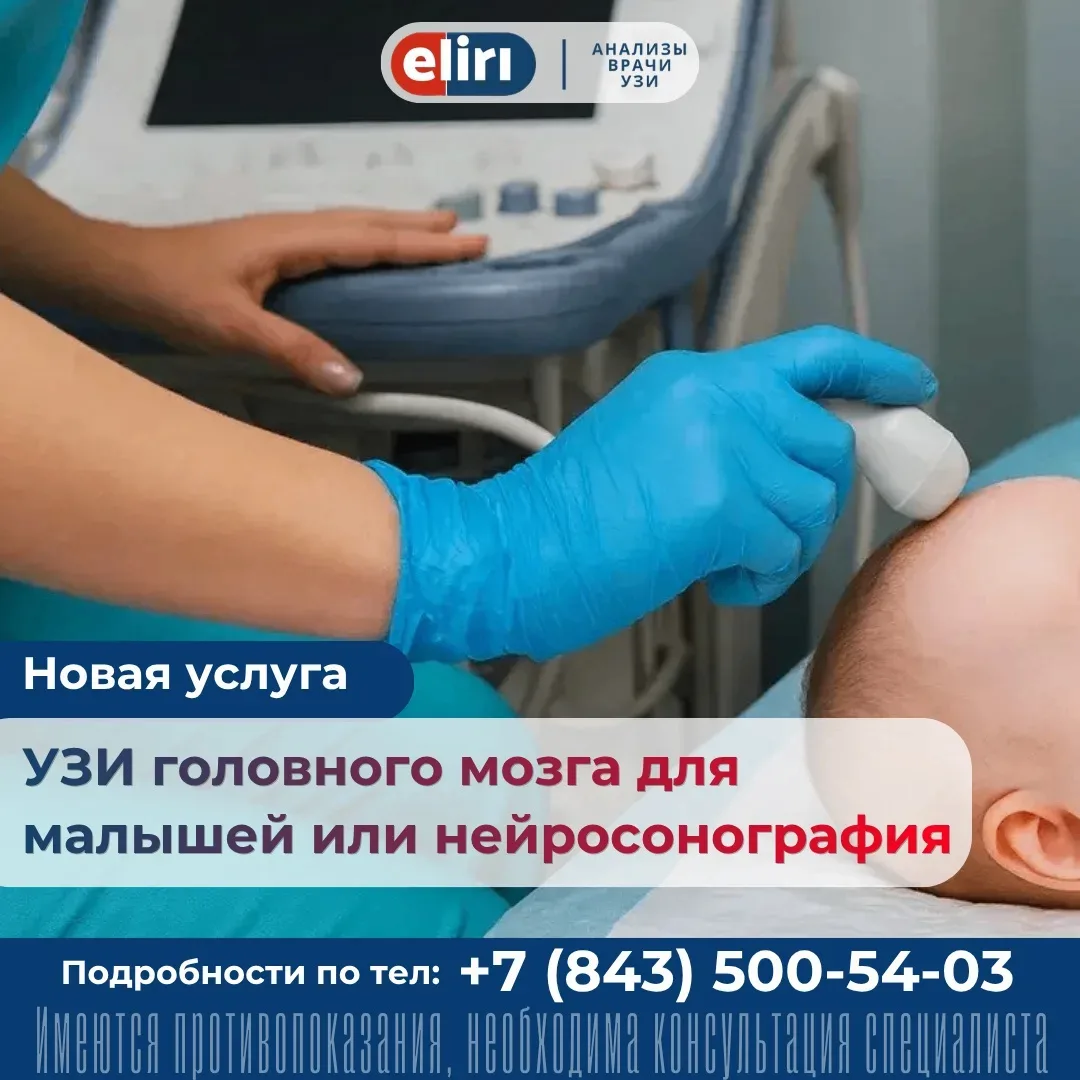 ⚡️Новая услуга в медцентре: УЗИ мозга для малышей или нейросонография