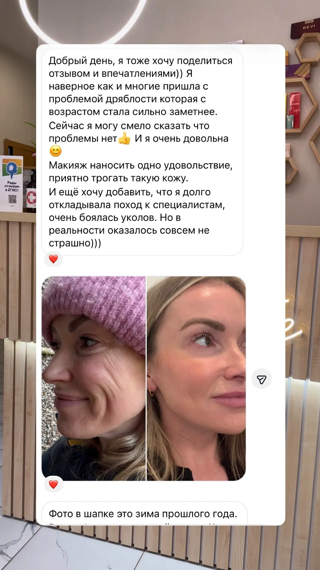 Ещё один отзыв сегодня🥰 Вас так много! Спасибо дорогие пациенты за выбор и благодарнос...