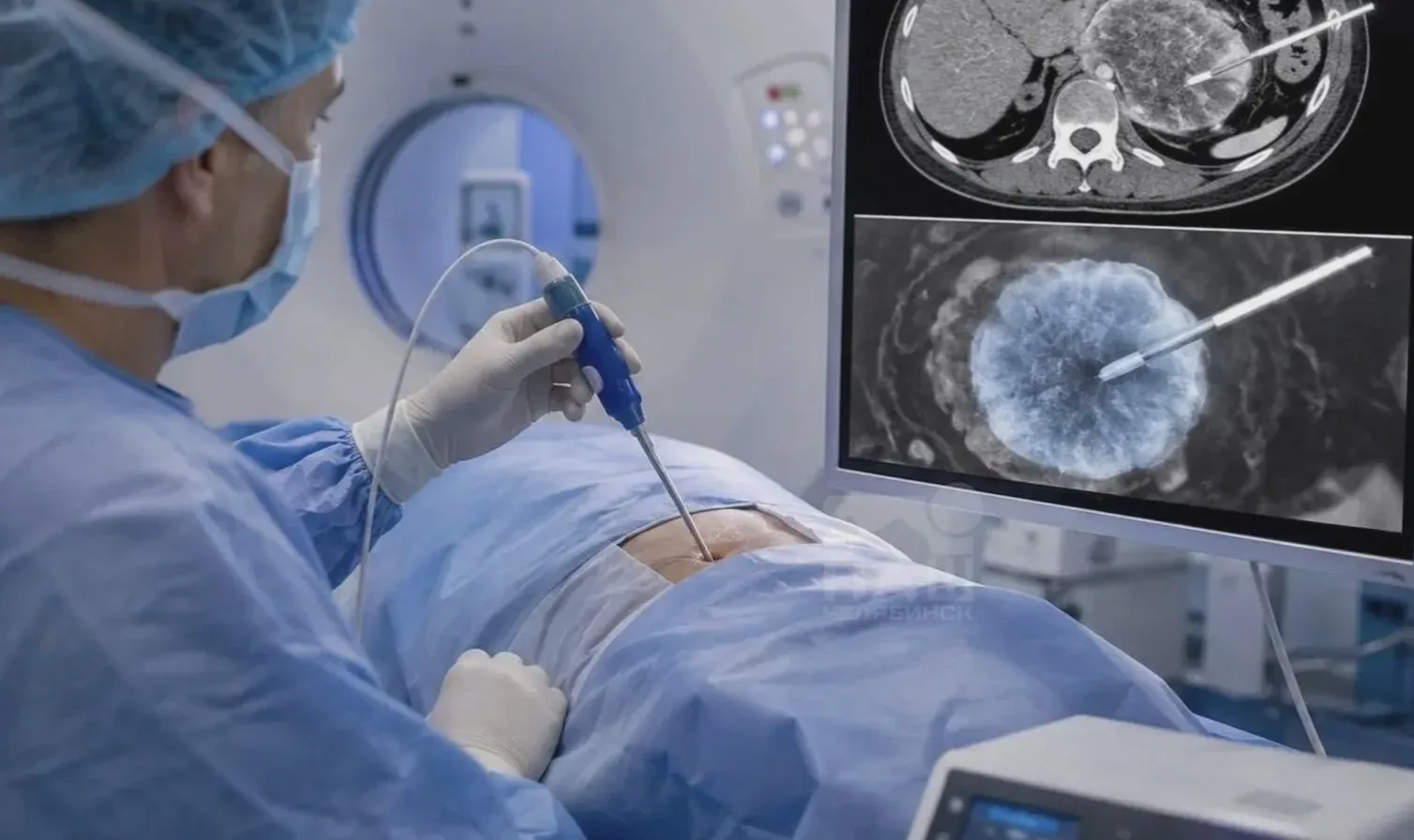 👩‍⚕️ В Челябинске удалили гигантскую миому
