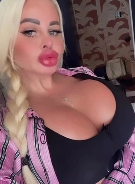 Уральская Барби из Екатеринбурга похвасталась новой гигантской грудью