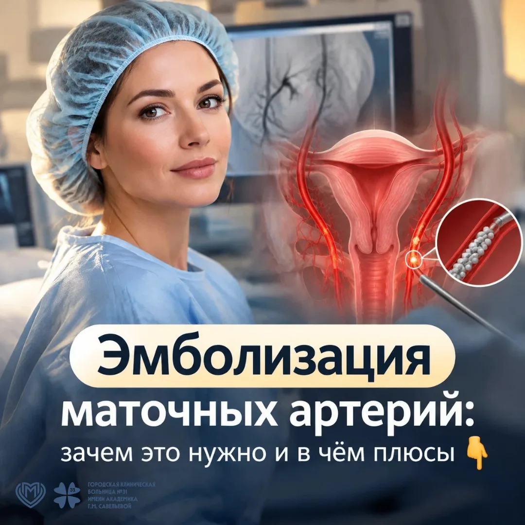 Эмболизация маточных артерий (ЭМА) — это малоинвазивная процедура, которую чаще всего д...