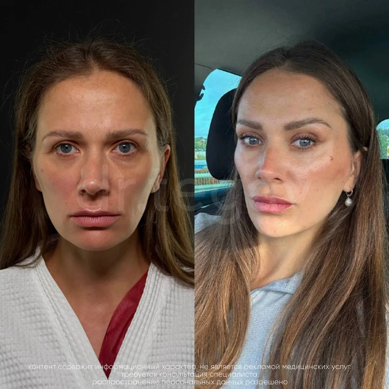Очень любим, когда пациенты делятся с нами своими фотографиями 😍
