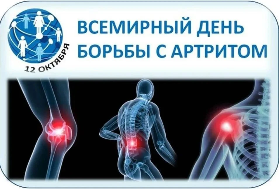 ✅ 12 октября - Всемирный день борьбы с артритом